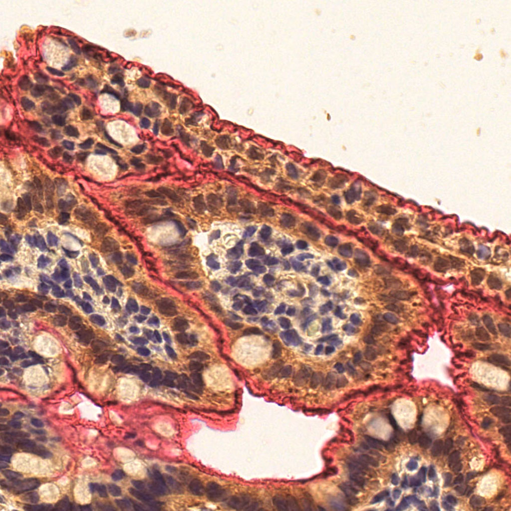 22PCW Intestine Higher Magnification